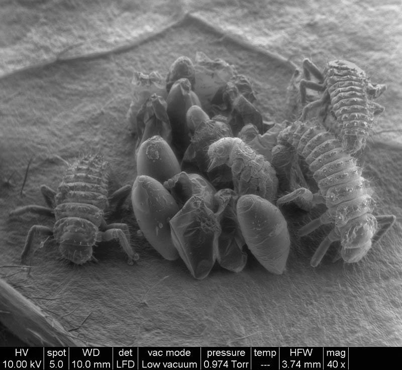 birth-of-ladybugs-macro-microscope-photograph-riccardo-antonelli