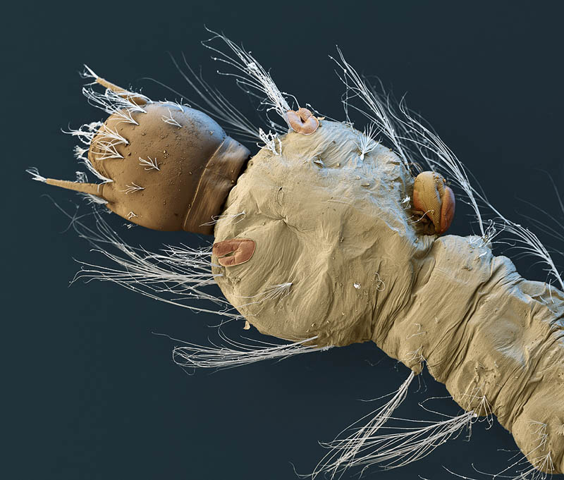 mosquito-larva-with-parasite-electron-microsope-image-nicole-ottawa
