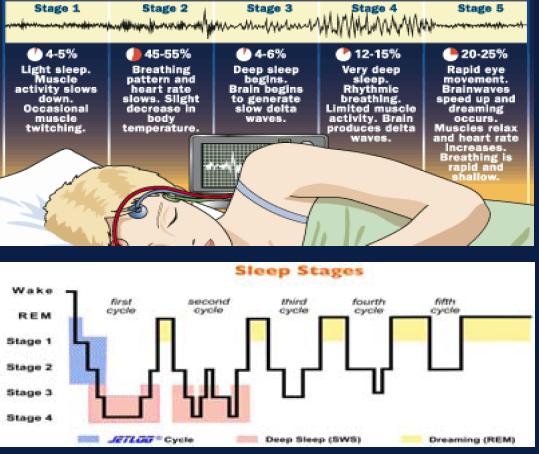 sleep-stages