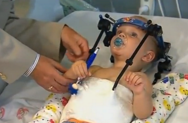 Toddler-Head-Reattached-3