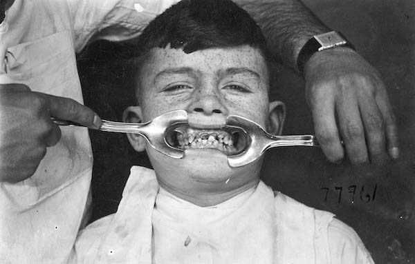 dental-equipment-from-the-past-5