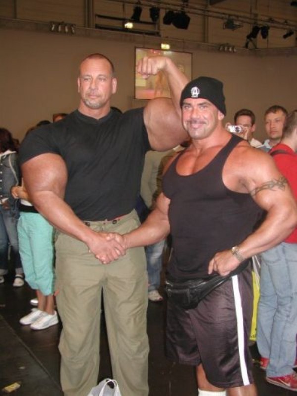 Injecting Synthol Gone Wrong 47 Pictures Memolition