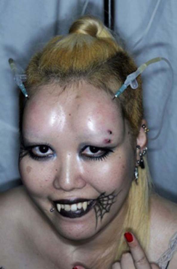 ‘Bagel Head’ Forehead Injections – Japan’s Hot New Beauty Trend (22