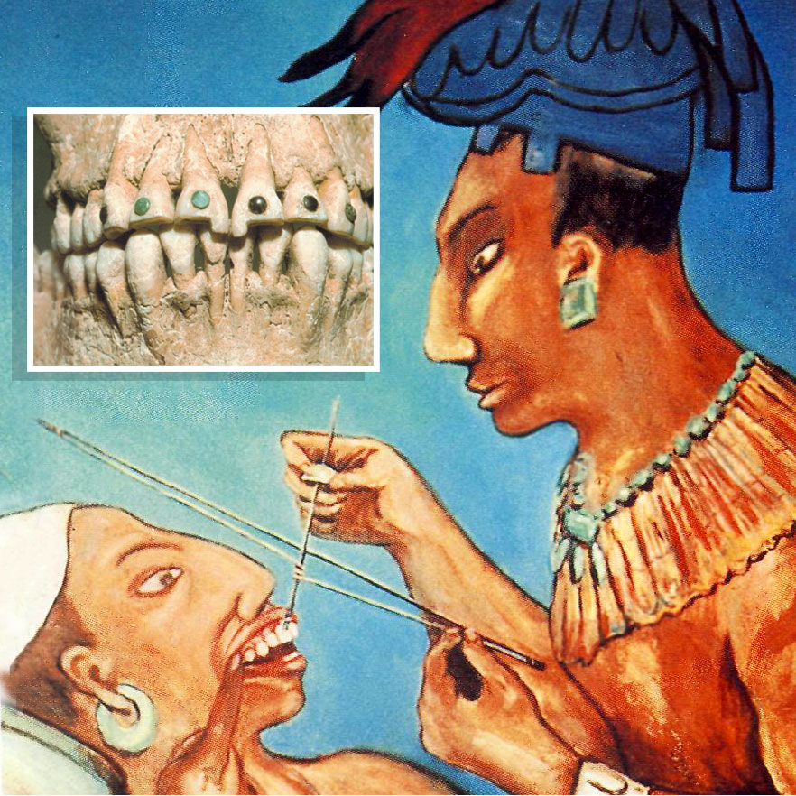 https://memolition.com/wp-content/uploads/2015/02/weird-but-beautiful-way-ancient-maya-used-to-decorate-their-teeth-49365.jpg